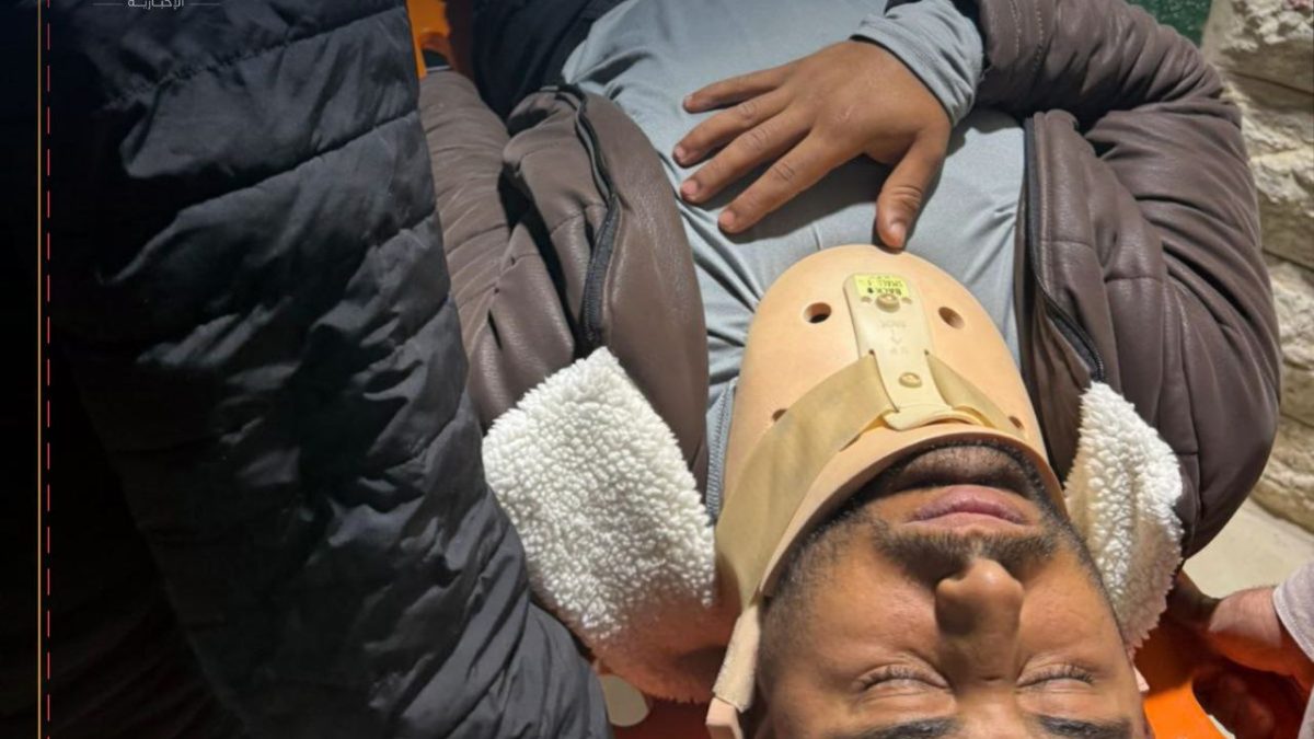 إصابات واعتقالات في بلدة سلوان جنوب الأقصى